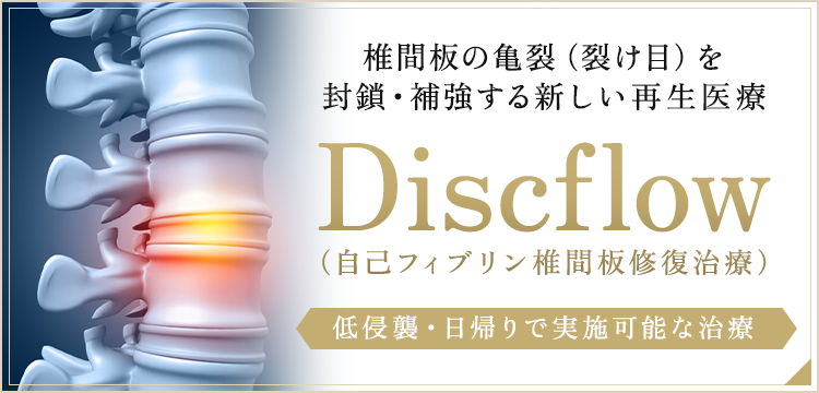 椎間板の亀裂（裂け目）を封鎖・補強する新しい再生医療 Discflow（自己フィブリン椎間板修復治療）