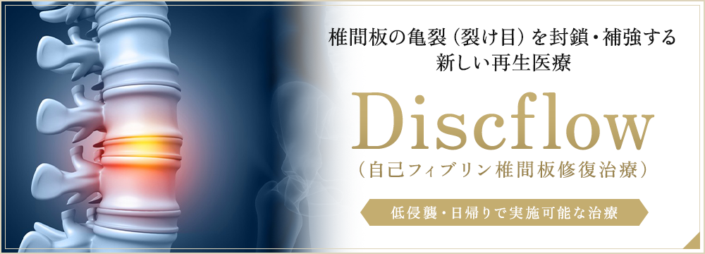 椎間板の亀裂（裂け目）を封鎖・補強する新しい再生医療 Discflow（自己フィブリン椎間板修復治療）