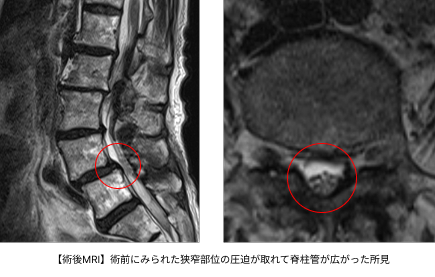 術後MRI_4615