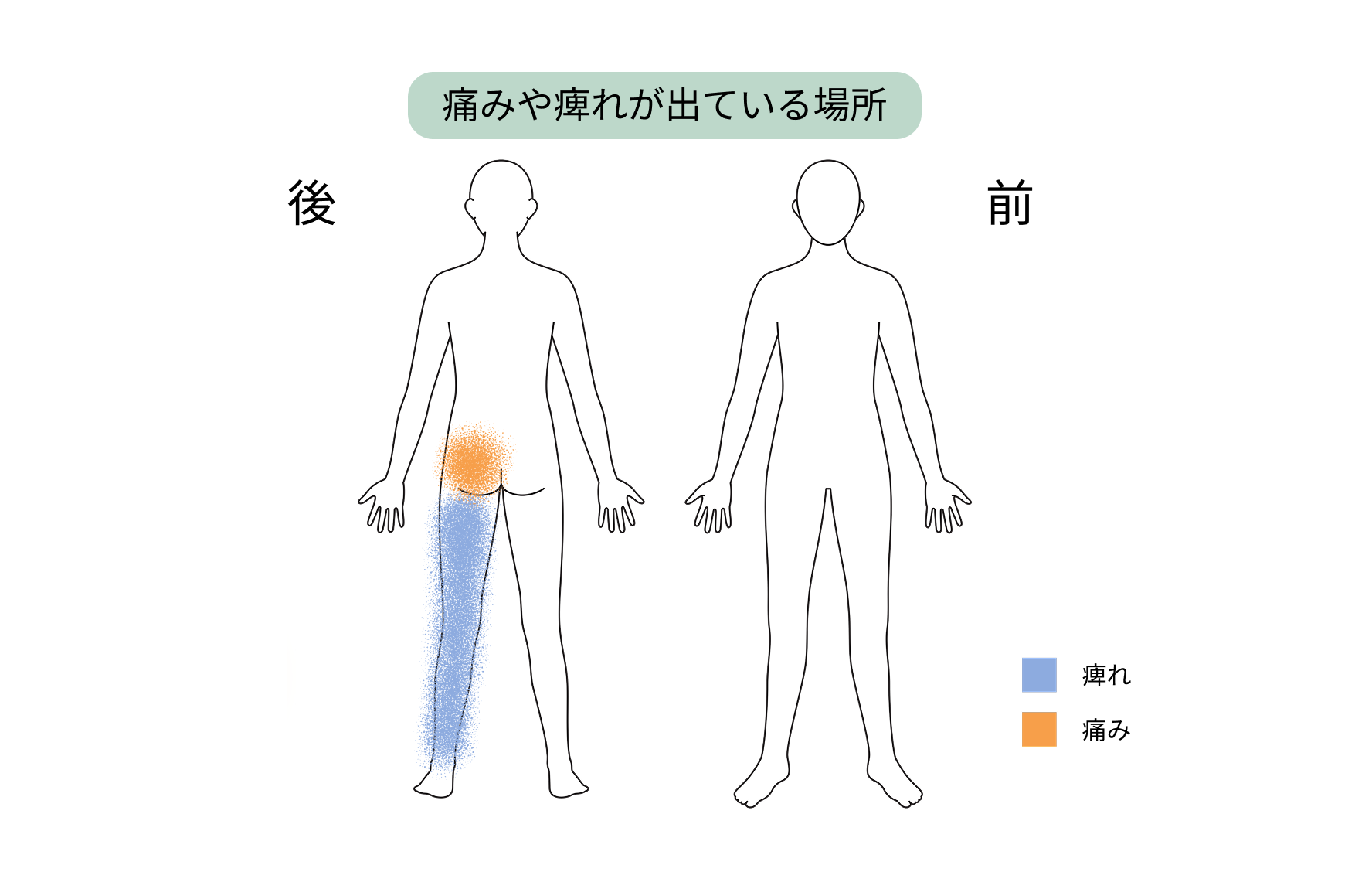 症状の出ている部位_4474