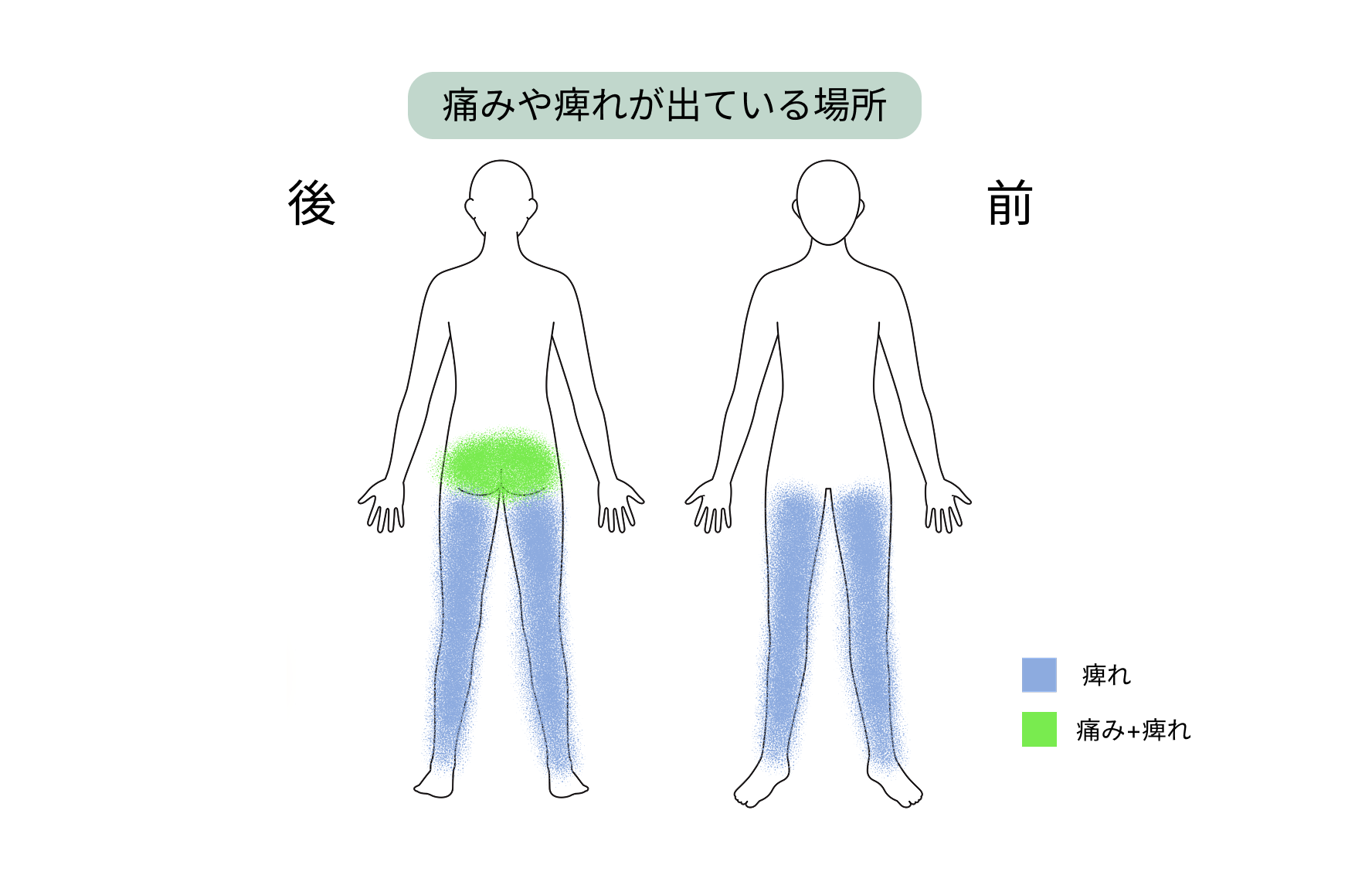 【症例紹介】椎間板ヘルニア手術後に痛みと痺れが残り、PELとPRP療法を行った50代男性の症例