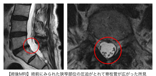 術後MRI_4682