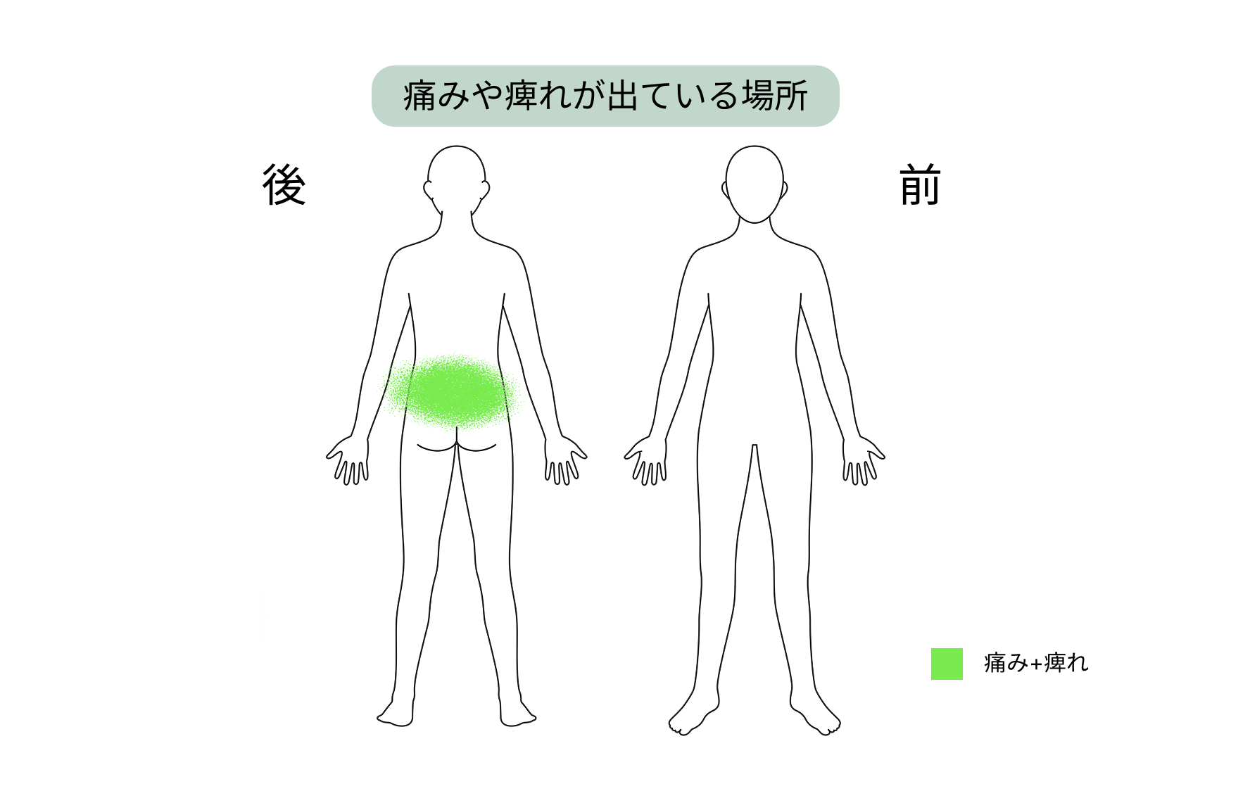 痛み・痺れの場所