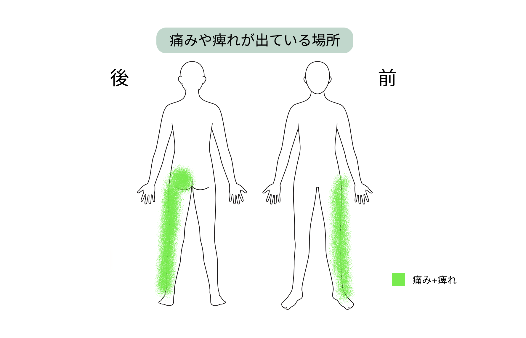 【症例紹介】脊柱管狭窄症による痛み・痺れに日帰り手術と幹細胞上清液投与を行った60代女性