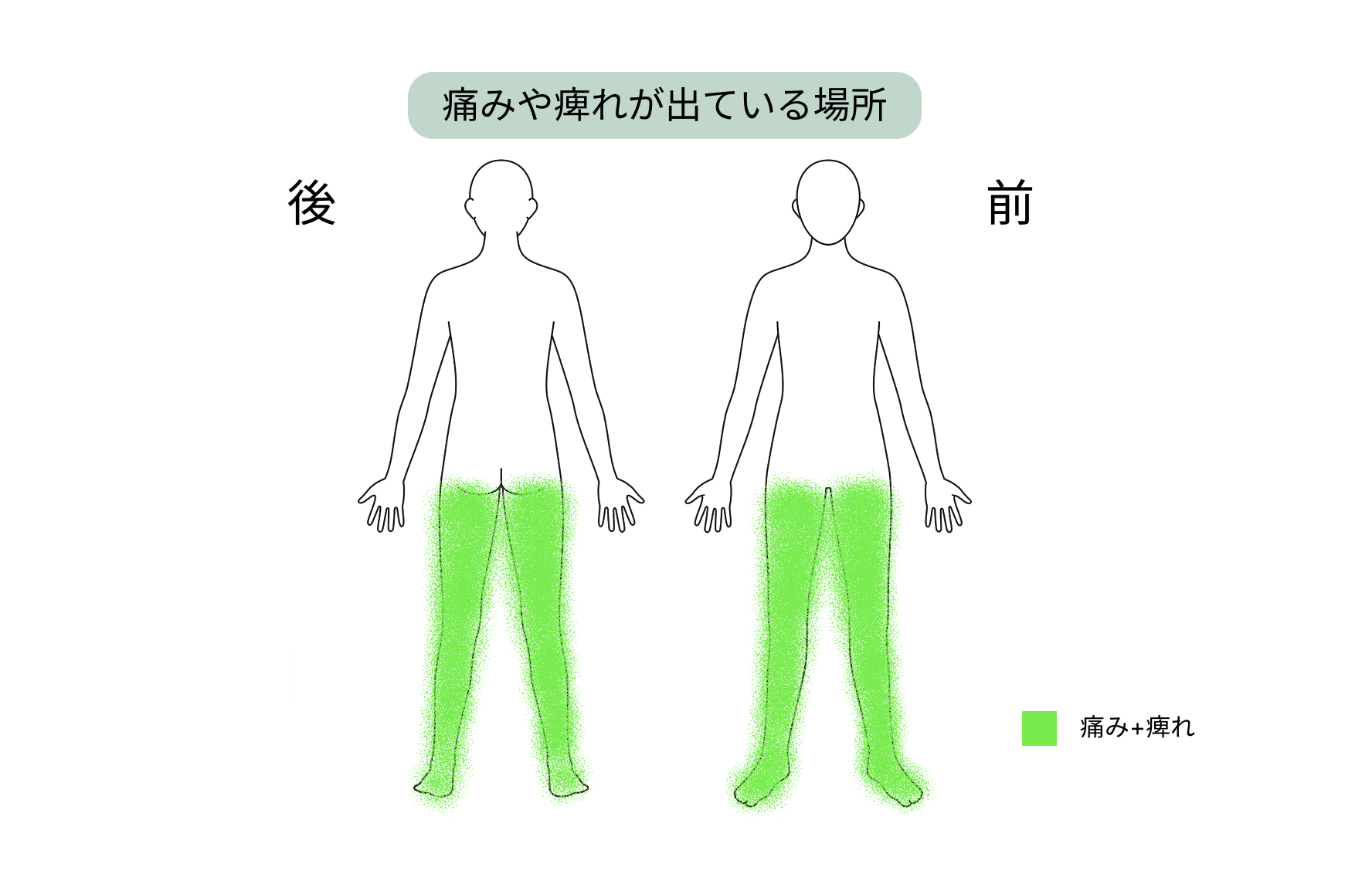 【症例紹介】両足の痺れと痛みで脊柱管狭窄症と診断され、日帰り手術を希望した70代男性の患者さん