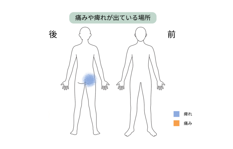 痛みが出ている場所の図