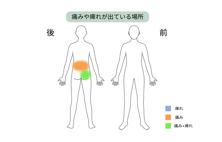 痛みが出ている部位の図