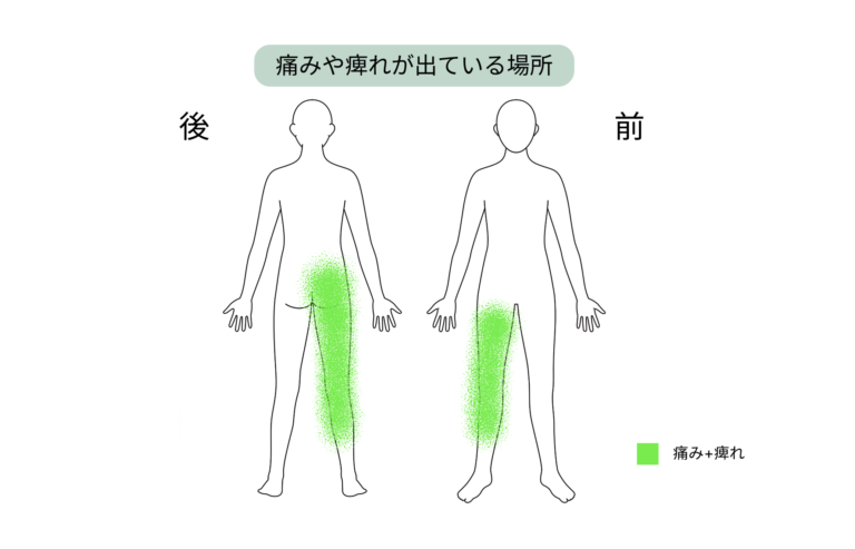 症状が出ている部位