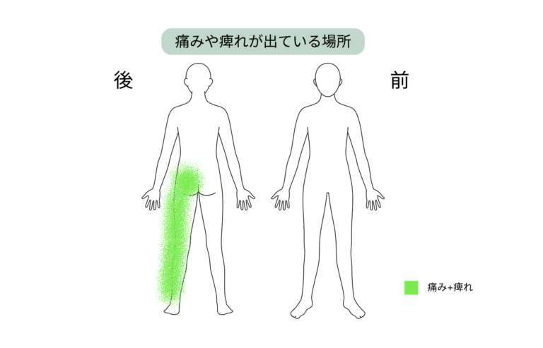 症状が出ている部位の図