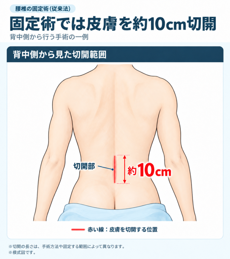 固定術の切開幅