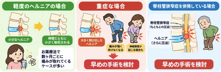 椎間板ヘルニアの重症度