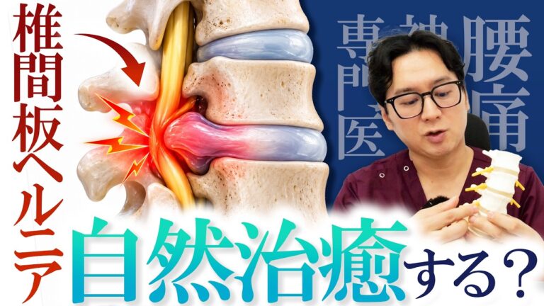 椎間板ヘルニアは自然治癒する?