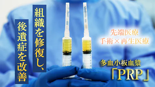 PRP療法