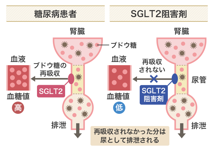 SGLT2阻害剤の効果