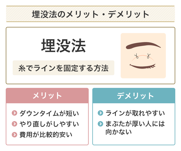 埋没法のメリットとデメリット