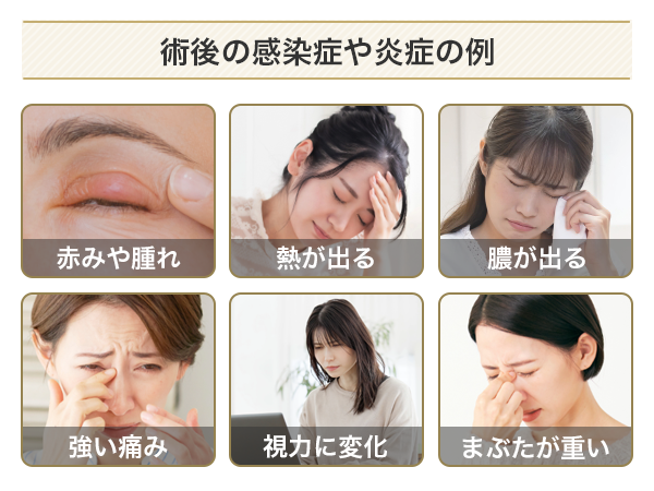 二重整形の術後に起こる感染症や炎症の例