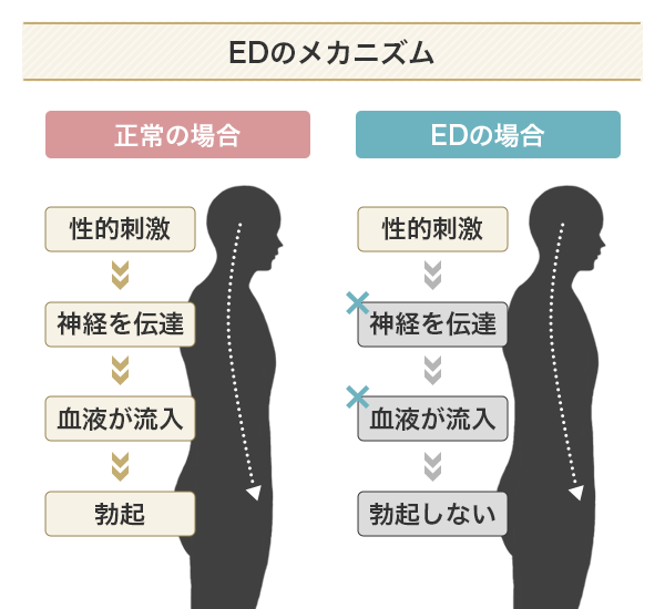 EDのメカニズム
