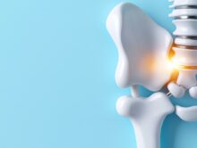 妊娠でも起こる「仙腸関節痛」とは｜腰痛の原因と再生医療による治療法