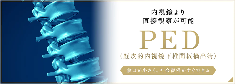 内視鏡より直接観察が可能PED（経皮的内視鏡下椎間板摘出術）傷口が小さく、社会復帰がすぐできる